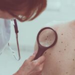 consulter un dermatologue