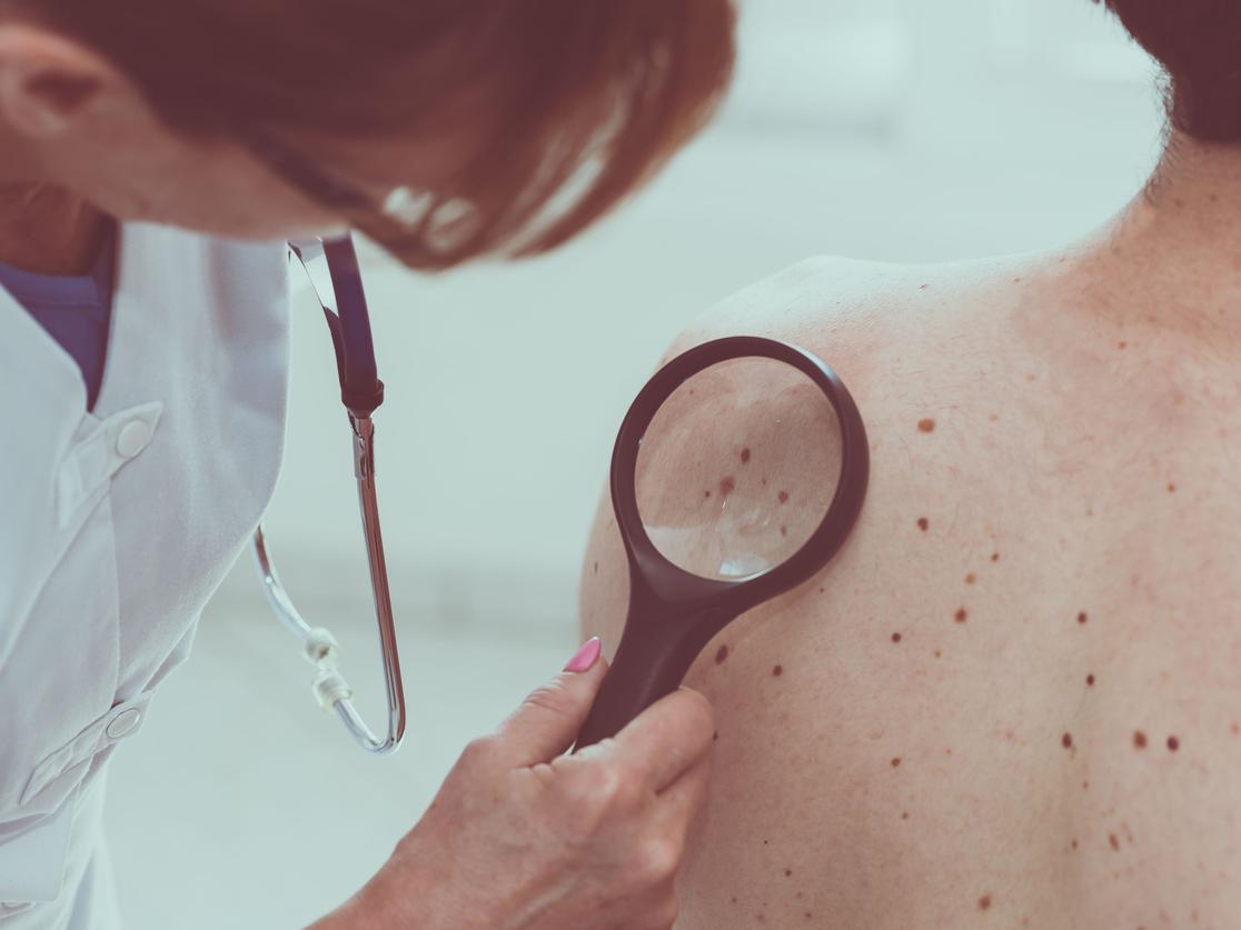 consulter un dermatologue